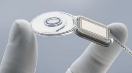 Image for Cochlear trialling next-generation, fully implantable hearing aids