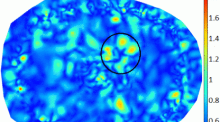 Image for Brain scanner manufacturer EMvision lists on ASX