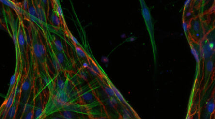 Image for Microfluidic chip could reduce radiotherapy side effects