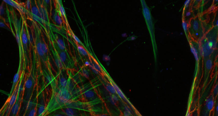 organ-on-a-chip-850×455