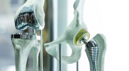 Image for Titanium is the perfect metal to make replacement human body parts