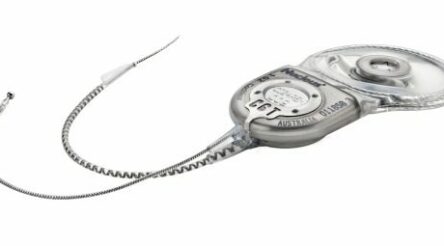 Image for Services drive Cochlear profits in competitive implant market