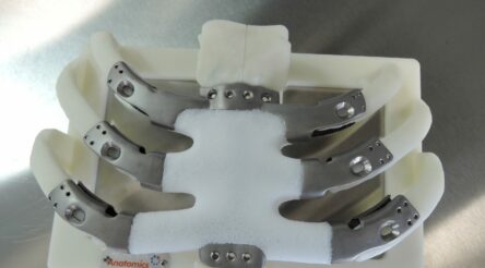 Image for World-leading implant manufacturer opens new Melbourne factory