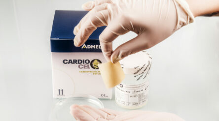 Image for Admedus sales win for cardio products