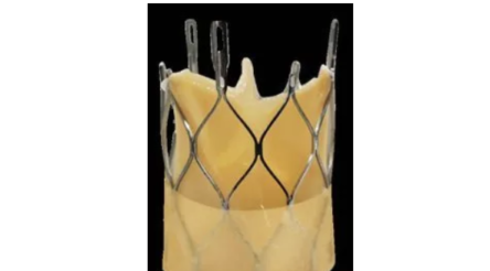 Image for Admedus receives approval for human heart valve implants