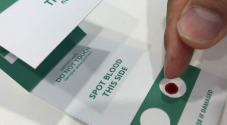 Image for Blood spot tests set to replace costly vials