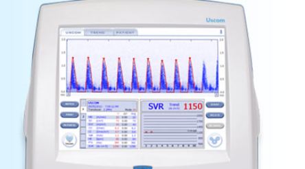Image for Uscom sales falter as China market opens