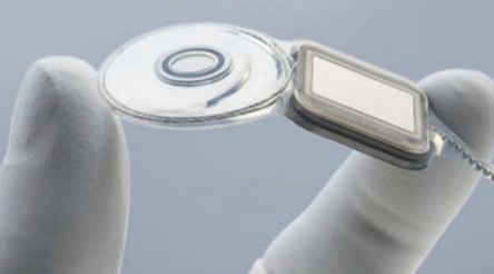 Image for Cochlear adds remote monitoring to its hearing implants