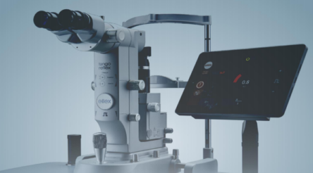 Image for ACCC to review sale of Ellex Medical Lasers