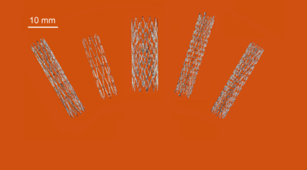 Image for CSIRO 3D prints complex heart stents