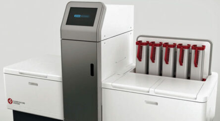 Image for First US sale for AI petri dish scanner