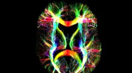 Image for Portable MRI system attracts $1 million development grant