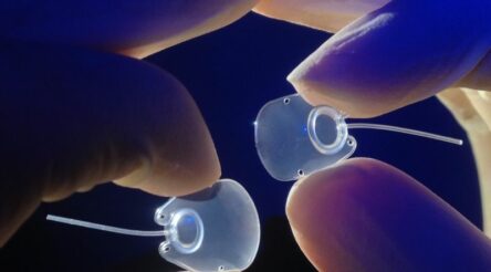 Image for Nova Eye Medical buys glaucoma business