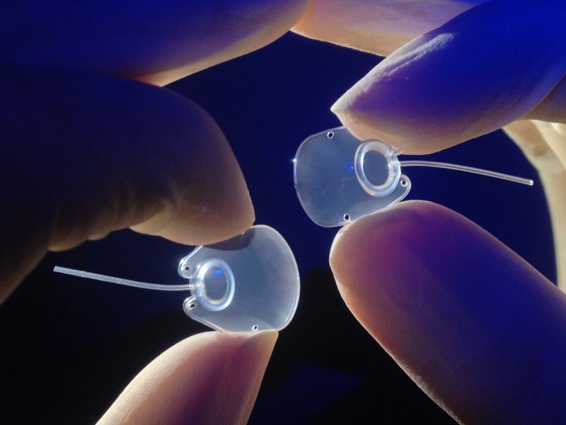 MOLTENO3 SL (on the left) and SS glaucoma implants