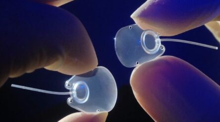 Image for Nova Eye Medical reports strong sales of glaucoma device