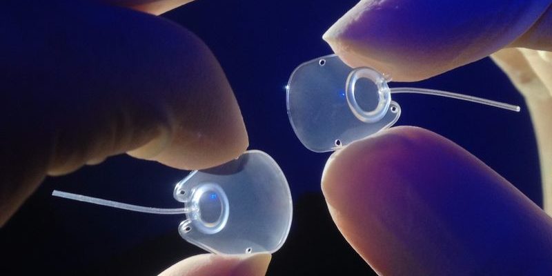 MOLTENO3 SL (on the left) and SS glaucoma implants