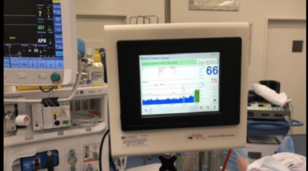 Image for Cortical Dynamics scores brain monitor approvals