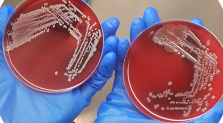 Image for Recce drug effective against Covid-19