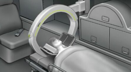 Image for Micro-X secures $8 million grant to develop CT stroke detection