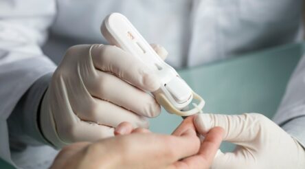 Image for Atomo Diagnostics HIV test to be more widely available