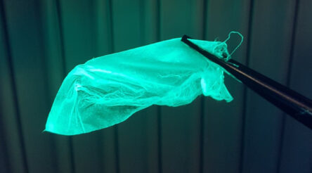 Image for Breakthrough could see cheaper, better bandages with built-in infection detection