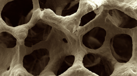 Image for Bones and beyond: Australian team pushes wonder-ceramic towards commercialisation