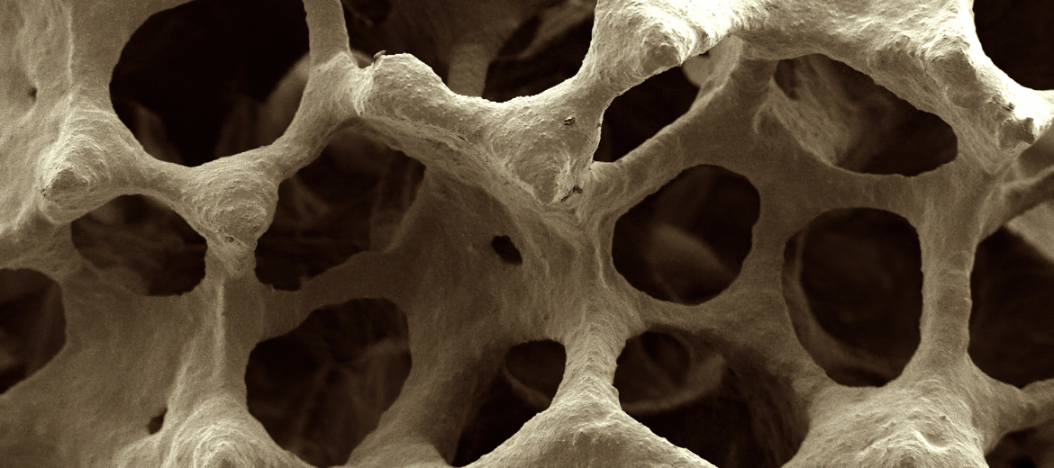 bonescaffold-SEM-srht-5al-2340×1040-1170×520