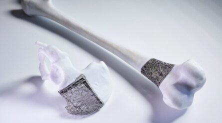 Image for Stryker to  establish Queensland medical technology innovation centre