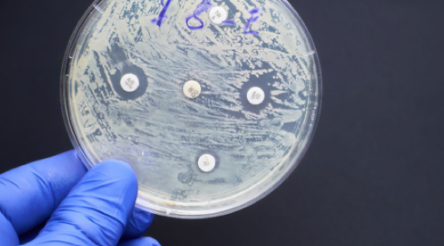 Image for Boost commercialisation to beat microbes – report