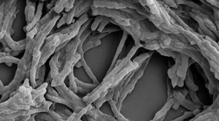 Image for Electricity from thin air: an enzyme from bacteria can extract energy from hydrogen in the atmosphere