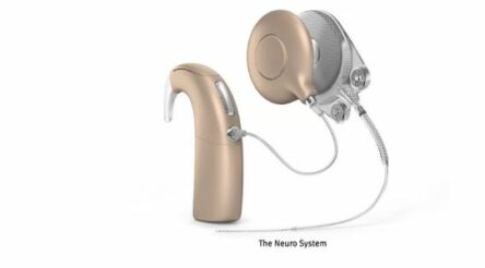 Image for Cochlear disagrees with new competition concerns over takeover