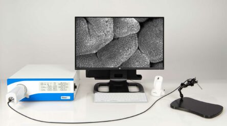 Image for Optiscan looks to raise $16.7 million through entitlement offer