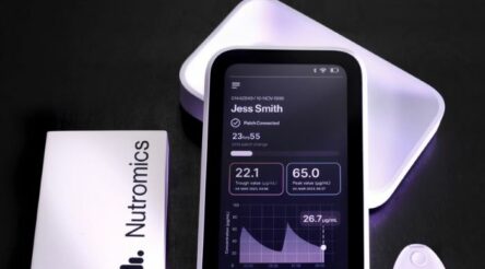 Image for Nutromics raises funds for wearable DNA monitoring