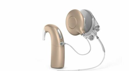 Image for Cochlear gets UK clearance to take over competitor