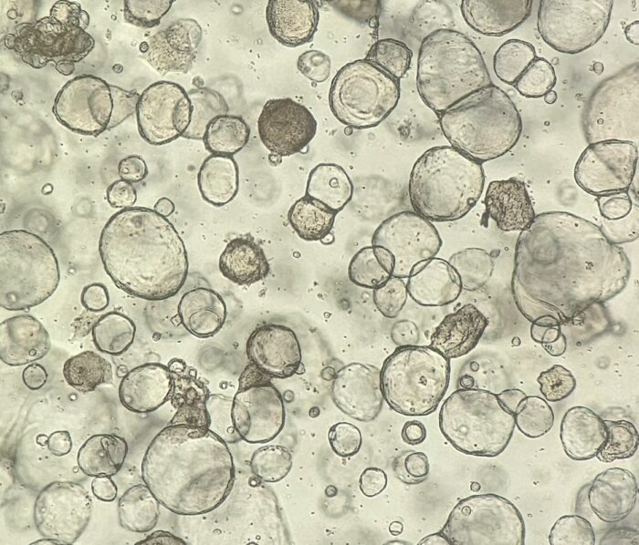 Organoids_1
