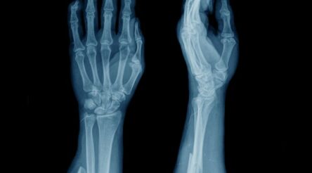 Image for Lab launched to make synthetic human bones