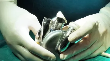 Image for MRFF awards $50 million to Australian team developing artificial heart