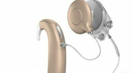 Image for Cochlear completes takeover of Oticon Medical cochlear implant business