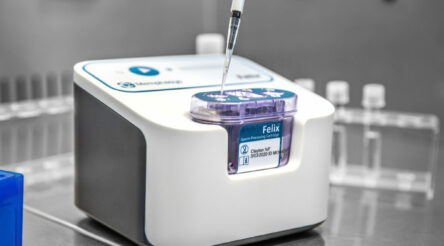 Image for Memphasys tech shows advantages in small-scale sperm preparation trial