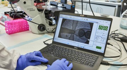 Image for Researchers hope silk-based breakthrough could help heal heart attack patients