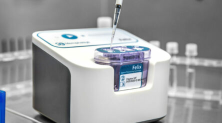 Image for Memphasys scheduled to complete clinical trial “by the end of the calendar year”