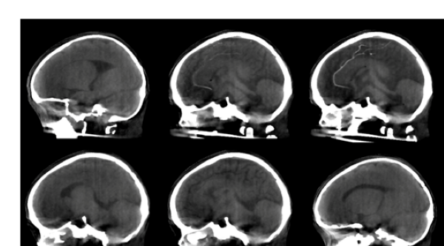 Image for Micro-X’s first 3D images from micro Head CT scanner