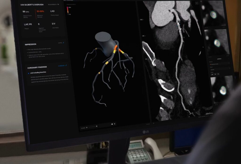 Artrya raises $15 million