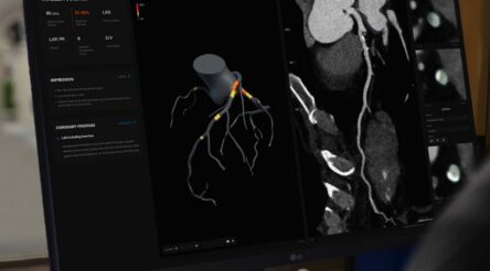 Image for Artrya raises $15 million