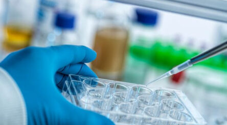 Image for UQ biotech innovation partnership forges a second startup