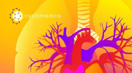 Image for Aussie medical tech scores big win in US market