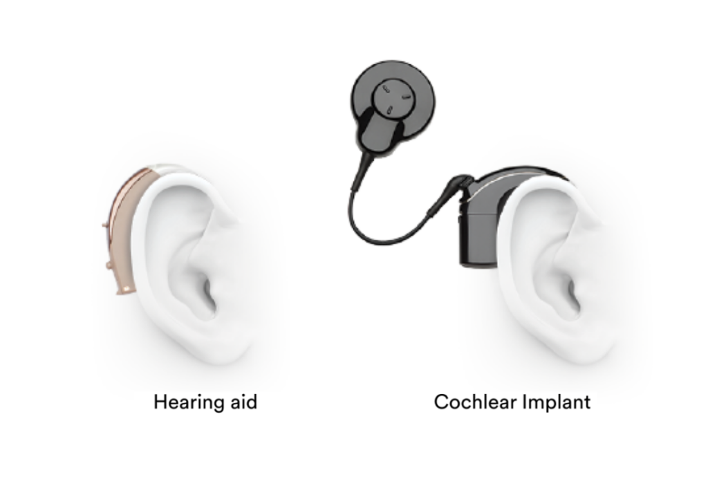 Cochlear seeking further detail on US tariffs