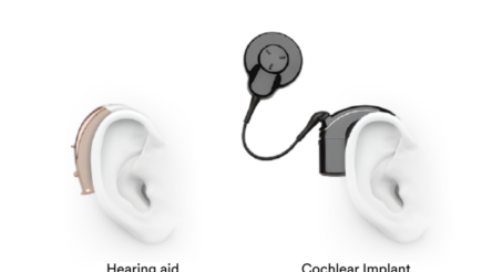 Image for Cochlear seeking further detail on US tariffs 