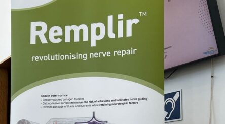 Image for Regulators clear Orthocell’s nerve repair product for sale in Canada