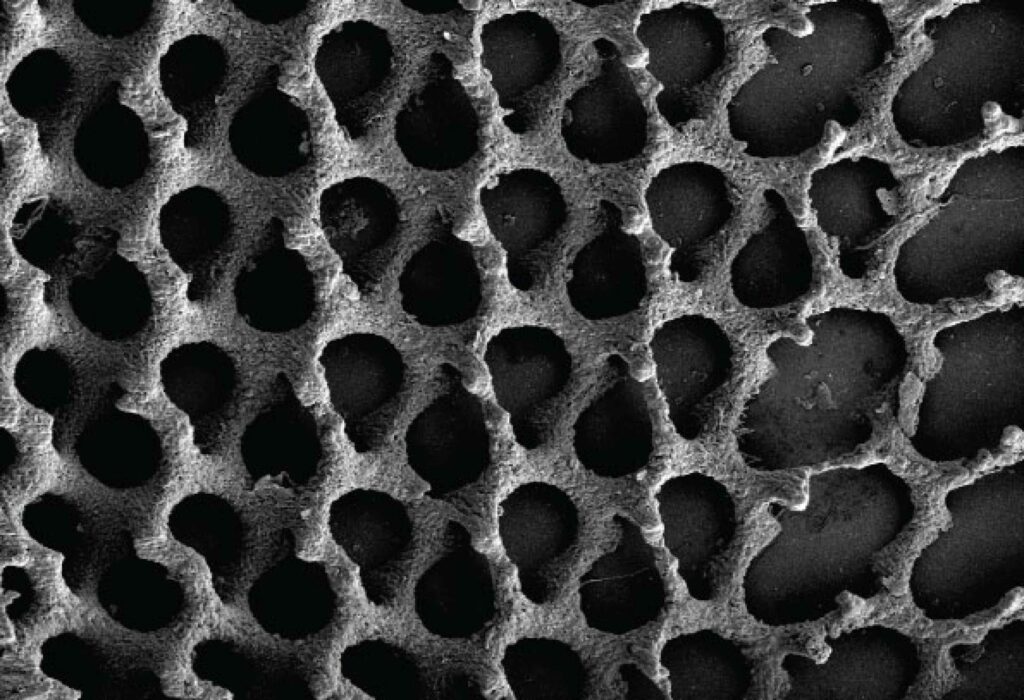 Researchers have developed the first nanoscale 3D printing technique for synthetic bone substitutes.